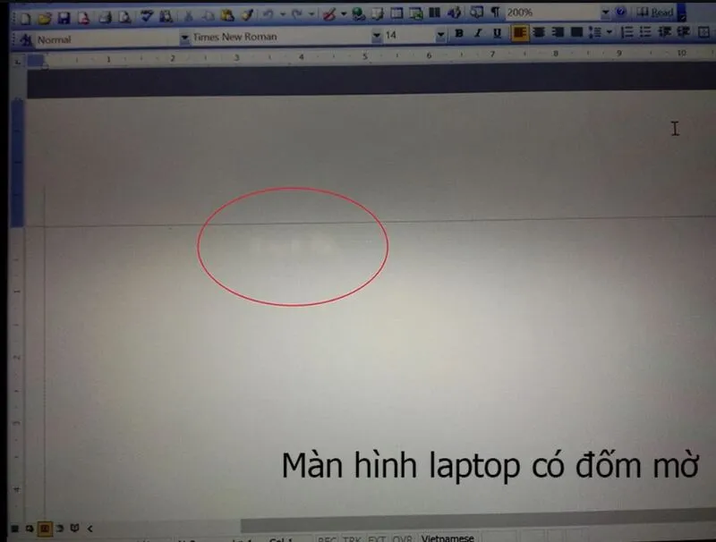Khác phục diẻm chét màn hình laptop 20